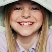 Серебрение зубов фото