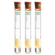 Пробирка для плазмолифтинга из стекла BD Vacutainer (гепаринат натрия + разделительный гель) фото