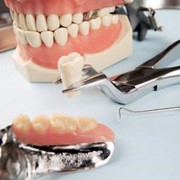 Удаление зубов фото