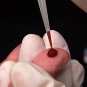 Анализ крови в лаборатории Invivo фото