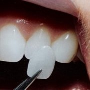Эстетическая стоматология фото