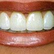 Эстетическая стоматология фотография