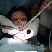 Лечение кариеса фото