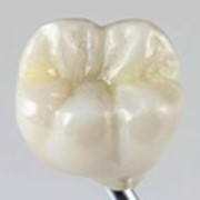 Протезирование зубов циркониевыми коронками фотография