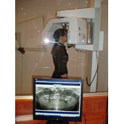 Панорамная цифровая рентгенография фото