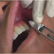 Средства для применения в стоматологии фото