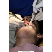 Ортодонтия фото