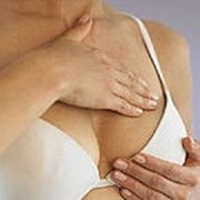 Диагностика и лечение мастопатии, рака молочной железы фотография