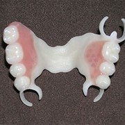 Протезирование зубов, съемные зубные протезы