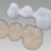 Протезирования зубов с использованием Циркония фотография