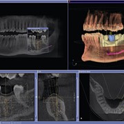 3D диагностика в стоматологии фото