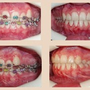 Ортодонтическое лечение, “Дент-ин“ фото