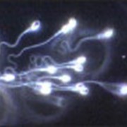Спермограмма фотография