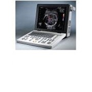 Сканер ультразвуковой портативный SONOACE R3 аппарат УЗИ