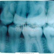 Диагностика жизнеспособности зуба Киев от компании Твоя Посмишка, ООО фотография