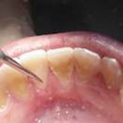 Профессиональная гигиена полости рта, Стоматологические услуги, Ортопедическая стоматология