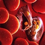Высокочувствительный экспресс-тест для определения антигена Малярии (Malaria) фотография