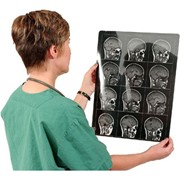 Магнитно-резонансная томография (МРТ) фото