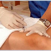 Озоновые уколы для суставов. Озонотерапия для суставов колен. Озоновые уколы для суставов. Фармакопунктура коленного сустава. Озоновые уколы для суставов.