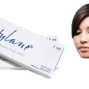 Контурная пластика