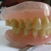 Литье нейлоновых зубных протезов! фото