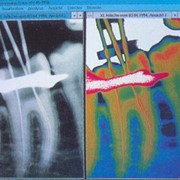 Цифровое рентгеновского изображе­ние