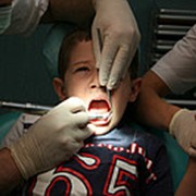 Удаление молочного зуба у ребенка.