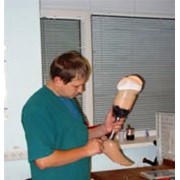 Протезирование нижних конечностей (ампутация ниже колена) фото