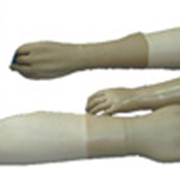 Изготовление протезов верхней конечности (предплечье) фотография