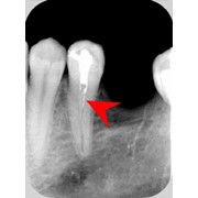 Лечение зубов и терапия в нашей клинике фото