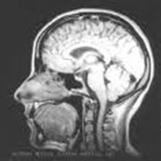 Томография головного мозга фото