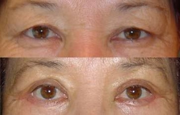 A father of many children from Chelny was sent to a colony-settlement for tortur