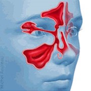 Магнитно-резонансная томография придаточных пазух носа фотография