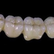 Протезирование зубов несъемное, Стоматологические услуги, Ортопедическая стоматология фото
