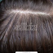 Лечение волос фото