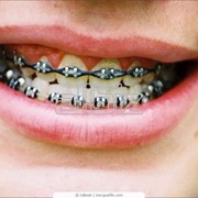 Материалы стоматологические фото