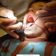 Лечение зубов у детей фото