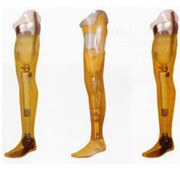 Протез нижней конечности (ампутация выше колена), протез ноги, стопы, производство, изготовление фото