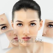 Очищение кожи лица фото