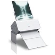Оцифровщик-сканер рентгеновских пленок Rayscan Plus фото