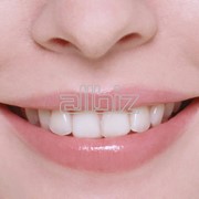 Серебрение зубов фото