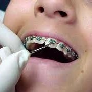 Ортодонтическая стоматология фото