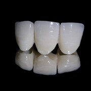 Ортопедические услуги, протезирование зубов фото