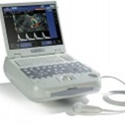Портативная ультразвуковая система для общих диагностических исследований MyLab Five фотография