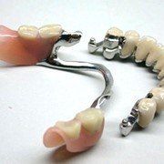 Протезирование зубов в Кишиневе фотография