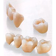 Современное протезирование зубов фотография