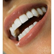 Лечение зубов и десен фото