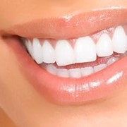 Чистка зубов, Удаление зубного камня фото