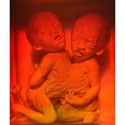 Голограмма художественная Сиамские близнецы фото