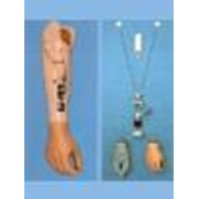 Изготовление миоэлектрического протеза верхних конечностей фото